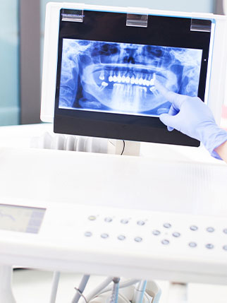 oral cancer screening